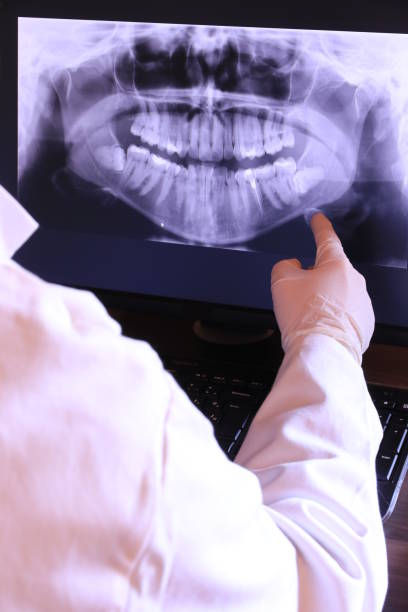 Best Emergency Dental Extractions in Eddington, PA